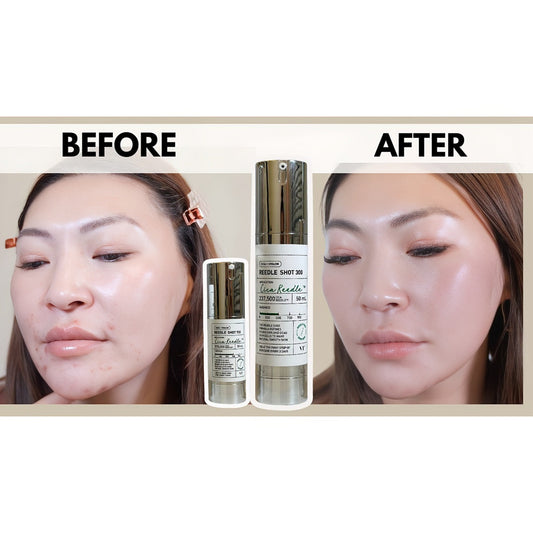 VT Cosmetics VT Reedle Shot 300 50ml