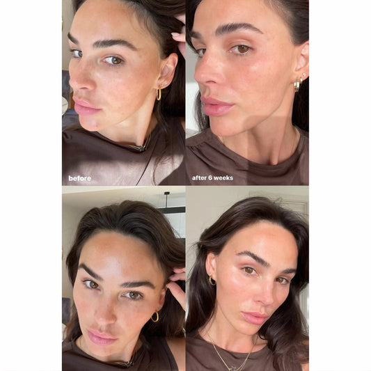 La Roche Posay Mela B3 Serum 30m