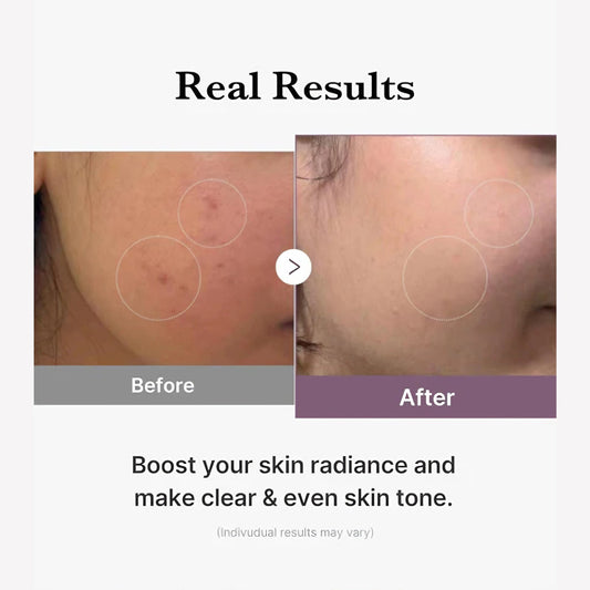 Medicube Age-R Glutathione Glow Serum 30g