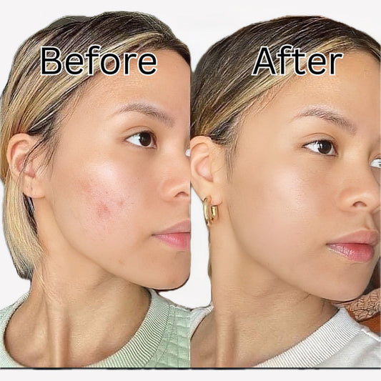 La Roche Posay Effaclar Ultra Concentre Serum 30ml