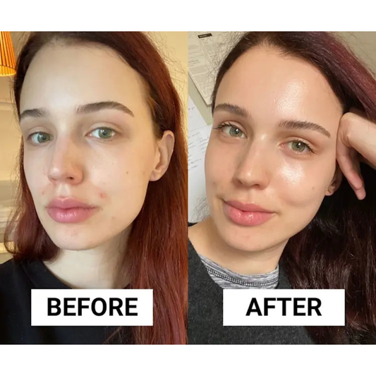 La Roche Posay Effaclar Duo + M 40ml