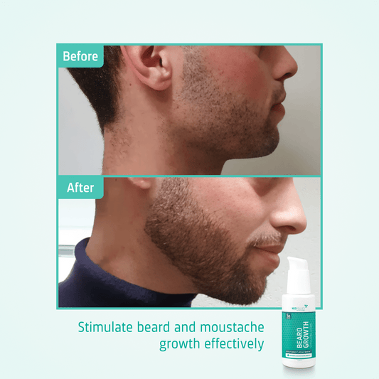 Neofollics Beard Growth Serum For Beard 45ml - Avoriell