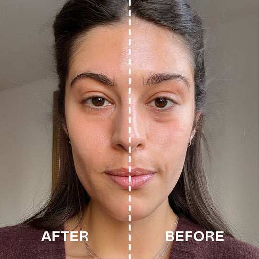 Medicube Age-R Booster Pro Mini