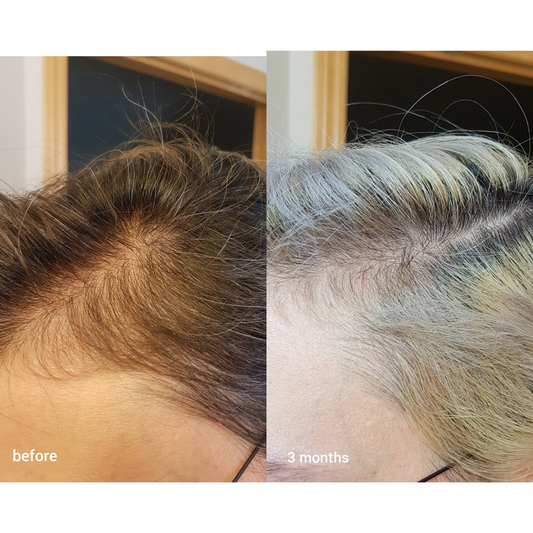 The Ordinary Multi-Peptide Serum for Hair Density 60ml
