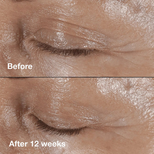 Clinique Smart Clinical Repair Rynkekorrigerende Øyekrem 15 ml