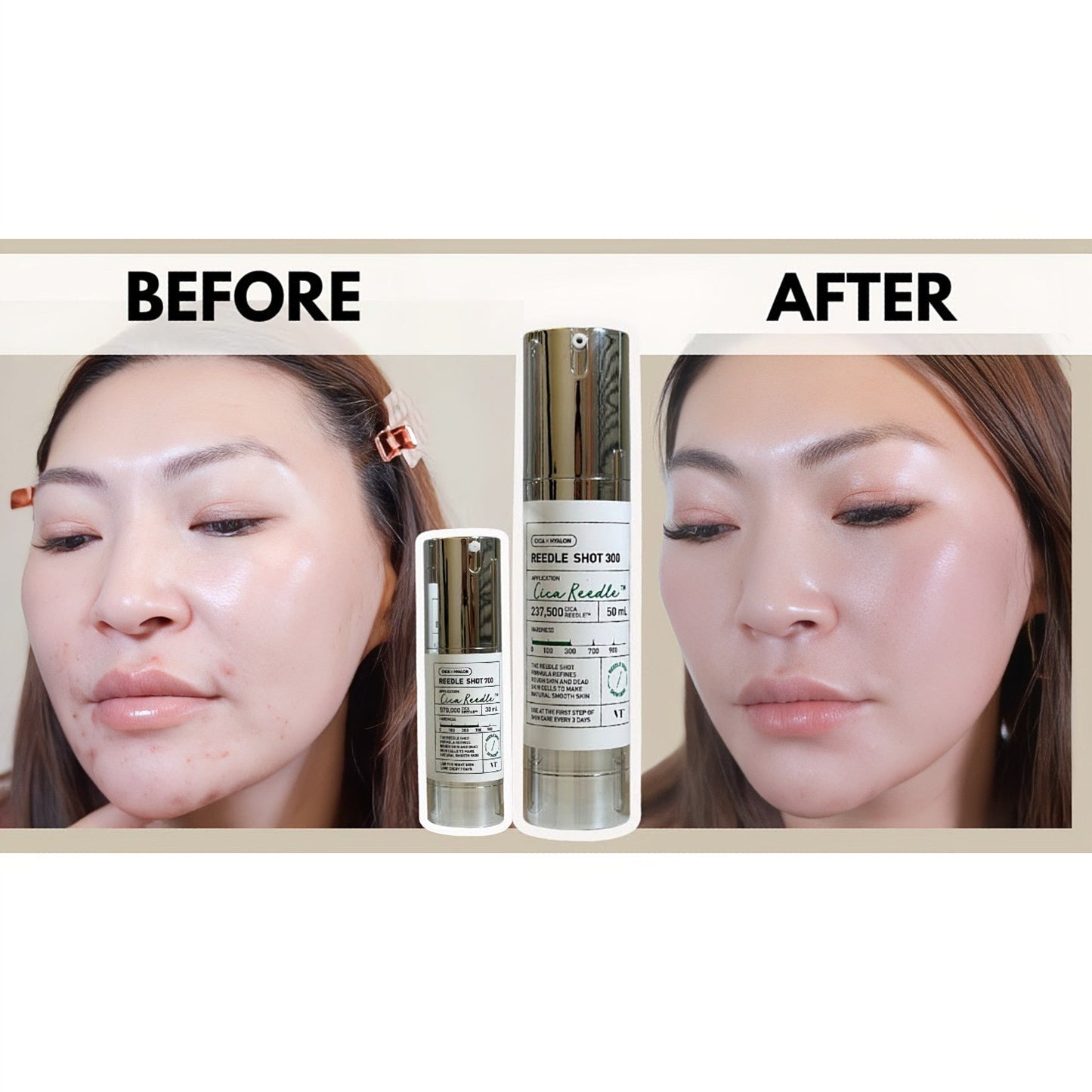 VT Cosmetics VT Reedle Shot 300 50ml