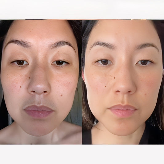 La Roche Posay Retinol  B3 Anti-Ageing Serum 30ml