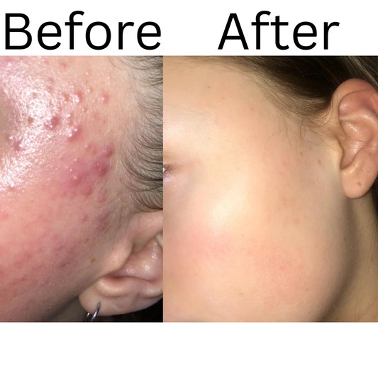 Purito Mighty Bamboo Panthenol Cream 100ml